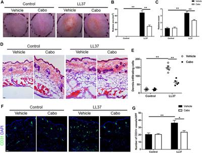 mTORC1-Mediated Angiogenesis is Required for the Development of Rosacea